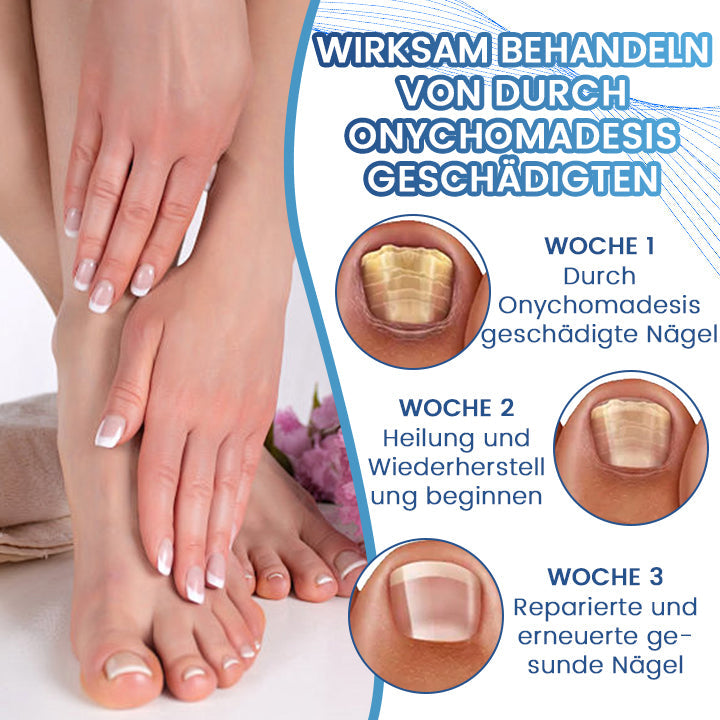 Biancat™ FungiFix Nagelpilz-Pflegefluid