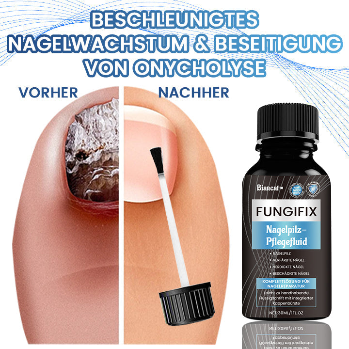 Biancat™ FungiFix Nagelpilz-Pflegefluid