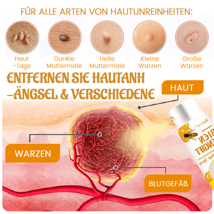 Biancat™ Bienenstich-Warzenpflegespray