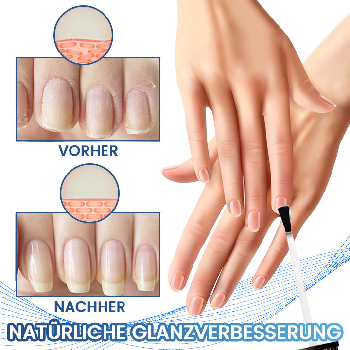 Biancat™ FungiFix Nagelpilz-Pflegefluid