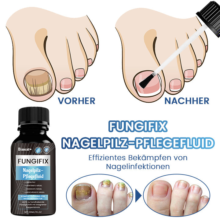 Biancat™ FungiFix Nagelpilz-Pflegefluid