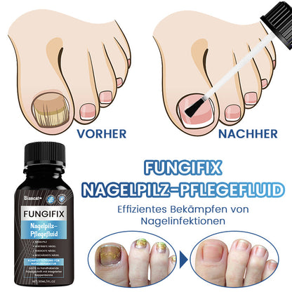 Biancat™ FungiFix Nagelpilz-Pflegefluid