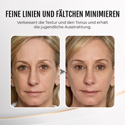 Biancat™ JugendLift Augenstraffungscreme